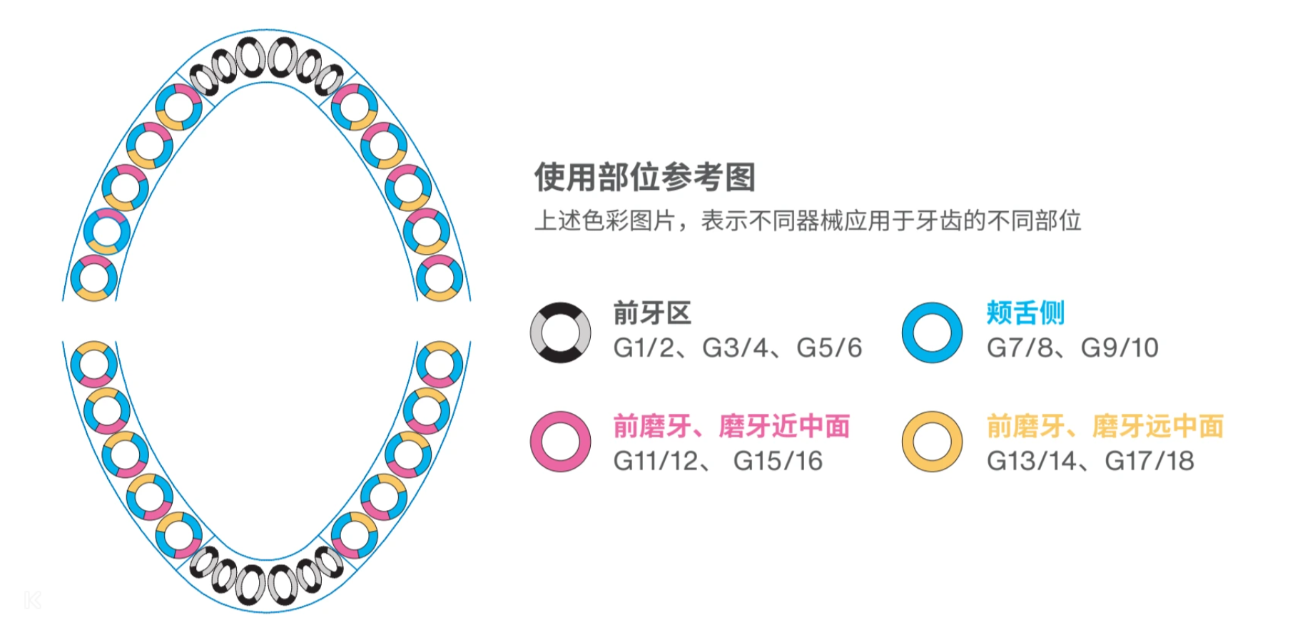 康桥 龈下刮治器（双头） 1920 3.png